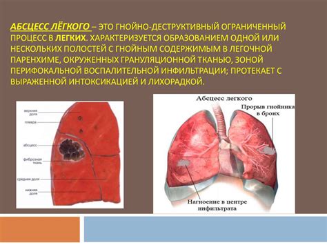 Абсцесс | lemur59.ru