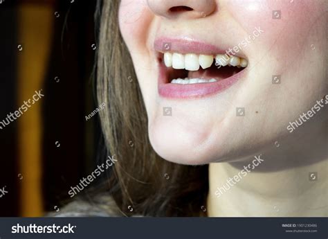 how to fix lack of tooth display