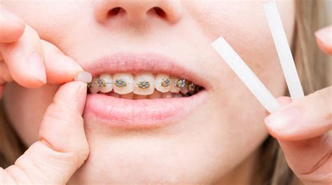 La guía más completa sobre las ceras dentales - Dentaltix