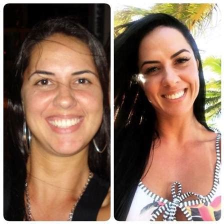 Graciele Lacerda Antes E Depois - Graciele Lacerda mostra diferença no rosto após mudança de hábitos e ...