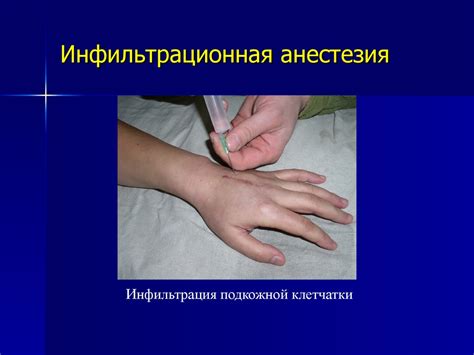Лекция №7. Основы современной анестезиологии - презентация онлайн