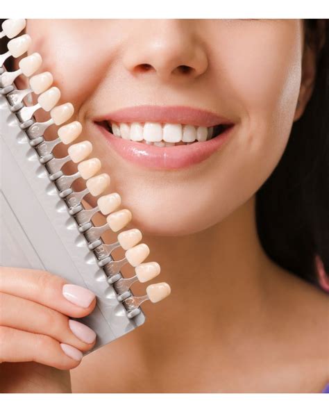 how much do veneers cost without insurance 5