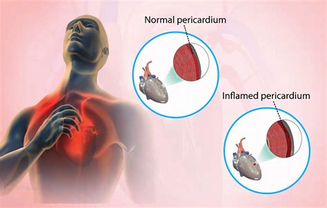 Health Condition : Symptoms, Causes, Treatment and More