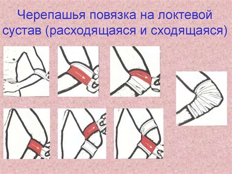 Походная медицина - презентация онлайн