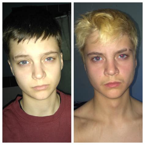 Facial Hair Growth Testosterone Ftm at Sammy Parra blog
