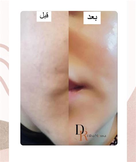‎هبة موسى |صيدلانية وخبيرة بشرة ‎ (@dr.hiba_mousa) • Instagram photos