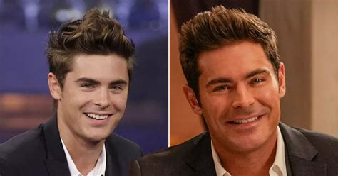 What happened to Zac Efrons face and did he have plastic surgery