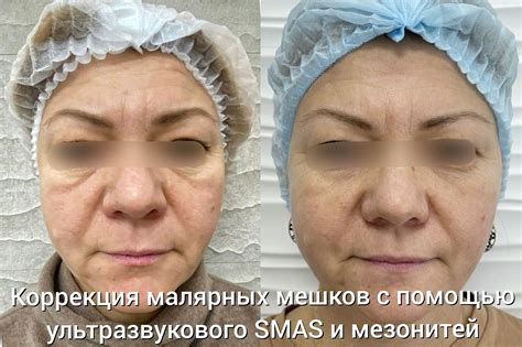 Отёки: откуда они берутся и как убрать?