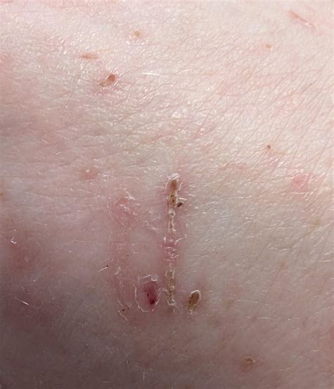 The shape of these scratches from my puppy looks... Familiar? | Scrolller