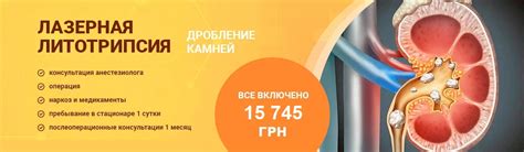Виды камней в почках: разновидности почечных камней | Добрый Прогноз