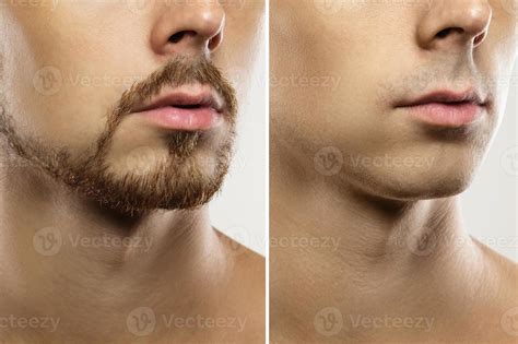 Male face Before and after shaving comparison. 16233976 Stock Photo at ...