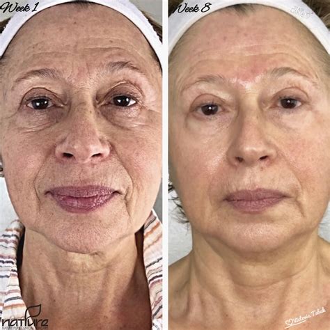 ESTHETICIAN RESOURCE: TREATMENT PROTOCOLS | Nature Pure Pro Holistic