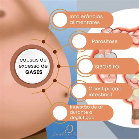 Rn Com Gases O Que Fazer - Dra. - A formação de gases ocorre como um processo natural no tubo ...