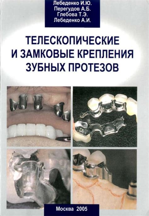 98.Телескопические и замковые крепления зубных протезов