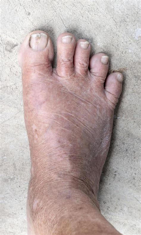 Right Foot Stock Photos, Images and Backgrounds for Free Download