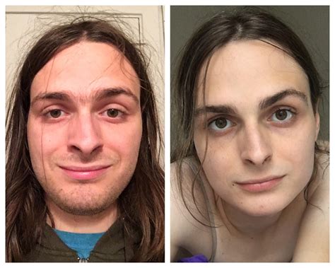 Estrogen Before And After