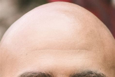 Slack Tide: The good, the bald and the ugly | Juneau Empire