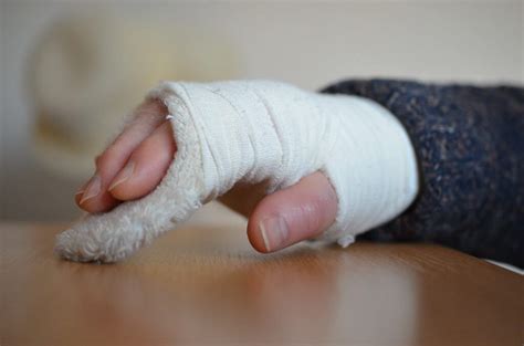 Kahnbeinbruch - Ursachen, Symptome, Behandlung