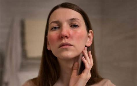 bentuk bibir ideal beserta tips merawatnya  tepat