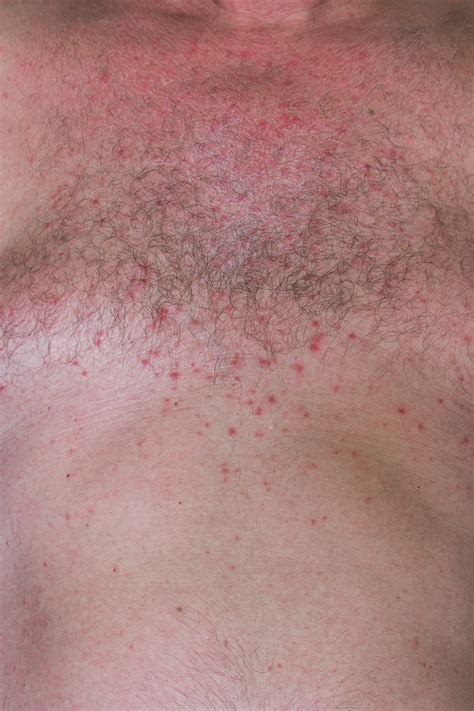 common skin rashes     skin itchy bumpy  red