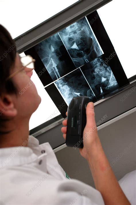 Hysterosalpingography - Stock Image - C030/9981 - Science Photo Library
