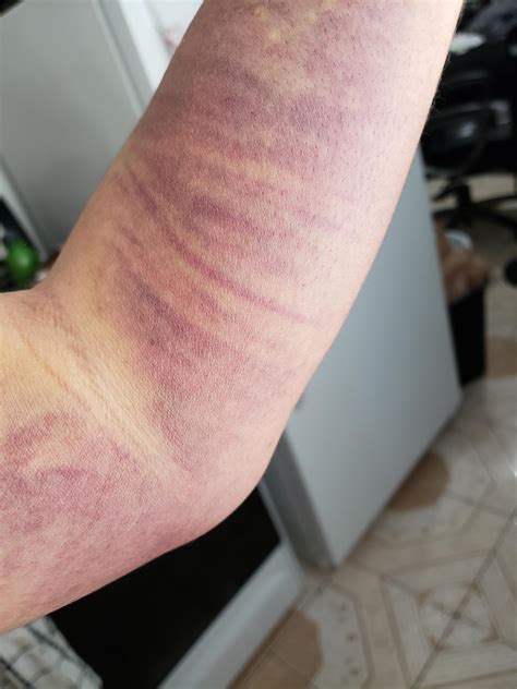 My Blood Hurts : Whenever I cum, my penis hurts really bad. I'm too