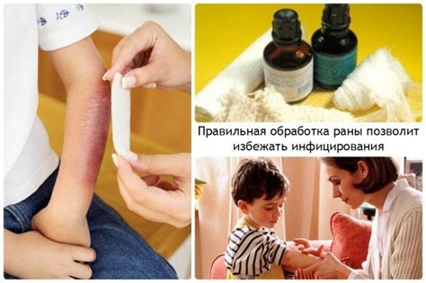 Как правильно обработать рану и чем можно обрабатывать? Vovet.ru