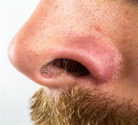 Nose - Key Stage Wiki