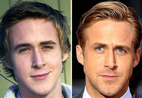 Ryan Gosling Nose Job Before And After