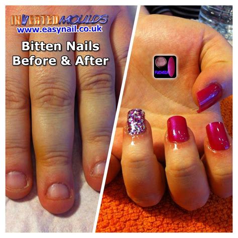 Acrylic Nails Bitten Nails before and after application of Inverted