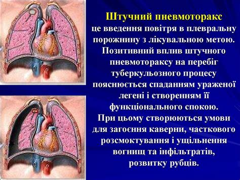 Принципи та сучасні методи лікування хворих на туберкульоз ...