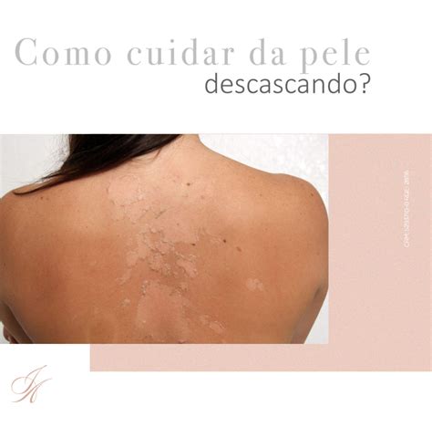O Que Fazer Quando A Pele Está Descascando - Como cuidar da pele descascando? - Dra. Joyce Arnaut