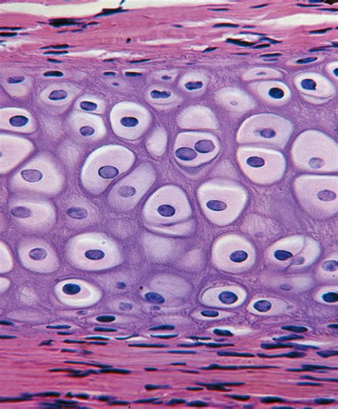 MBBS Medicine (Humanity First): Cartilage histology