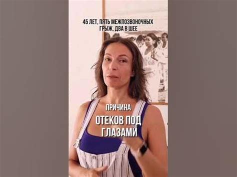 Причина отеков под глазами! - YouTube