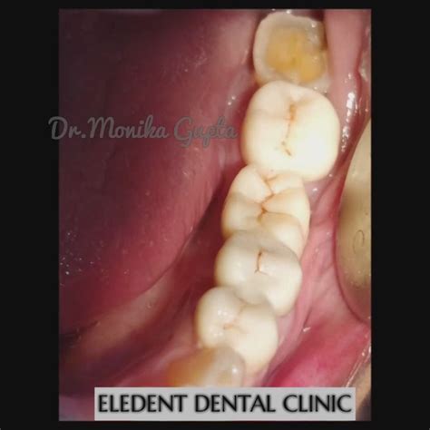 Eledent Dental Clinic - Home