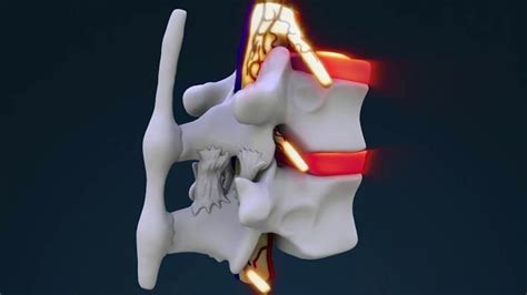 VIDEO: What Is Chiropractic? | Chironexus News