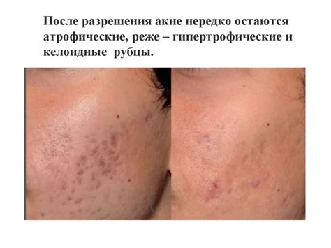 Болезни кожи - презентация онлайн