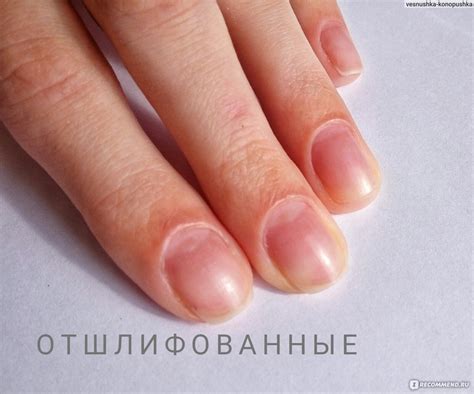 Виды кутикулы (48 фото) - картинки modnica.club