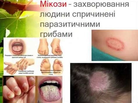Гриби-паразити - YouTube