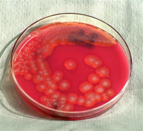 Bacillus Cereus Gram Stain