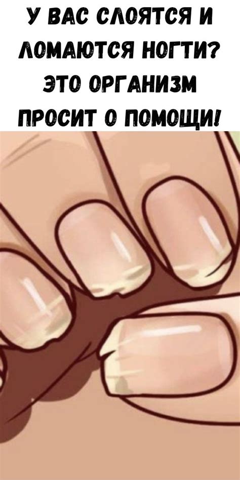 У вас слоятся и ломаются ногти? Это организм просит о помощи! - Советы ...
