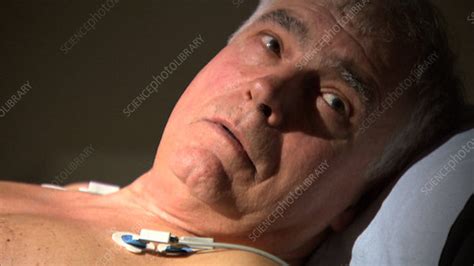 echocardiography procedure stock video clip  science