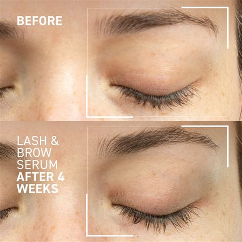 Lash and Brow Serum for Fuller, Healthier Hair Growth - Dr. Brandt Skincare