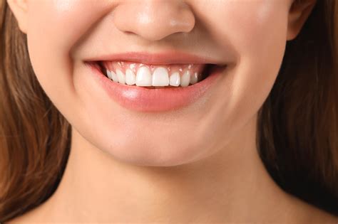 White Gums: 3 Causes for Gums That Turn White