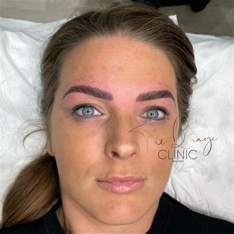 Brow Lamination in Hornchurch, Essex