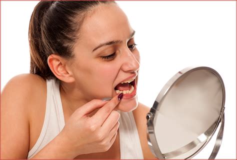 shouldnt ignore  chipped tooth emedihealth