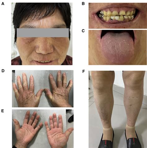 patients clinical manifestations  scientific diagram