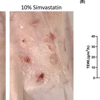 Effects of simvastatin cream on tissue markers of fibrosis. (A