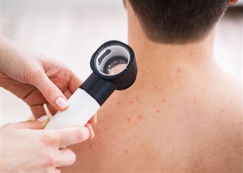 Acne Treatments | Dermatology Inc.