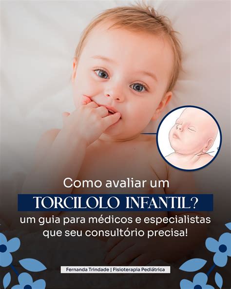 Remedio Torcicolo Infantil - COMO AVALIAR TORCICOLO INFANTIL? - UM GUIA PARA MÉDICOS E ESPECIALI...